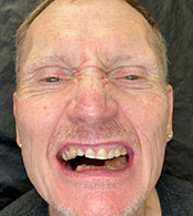 Bill-before