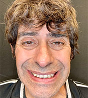 Hector-before