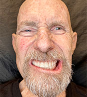 Paul-after