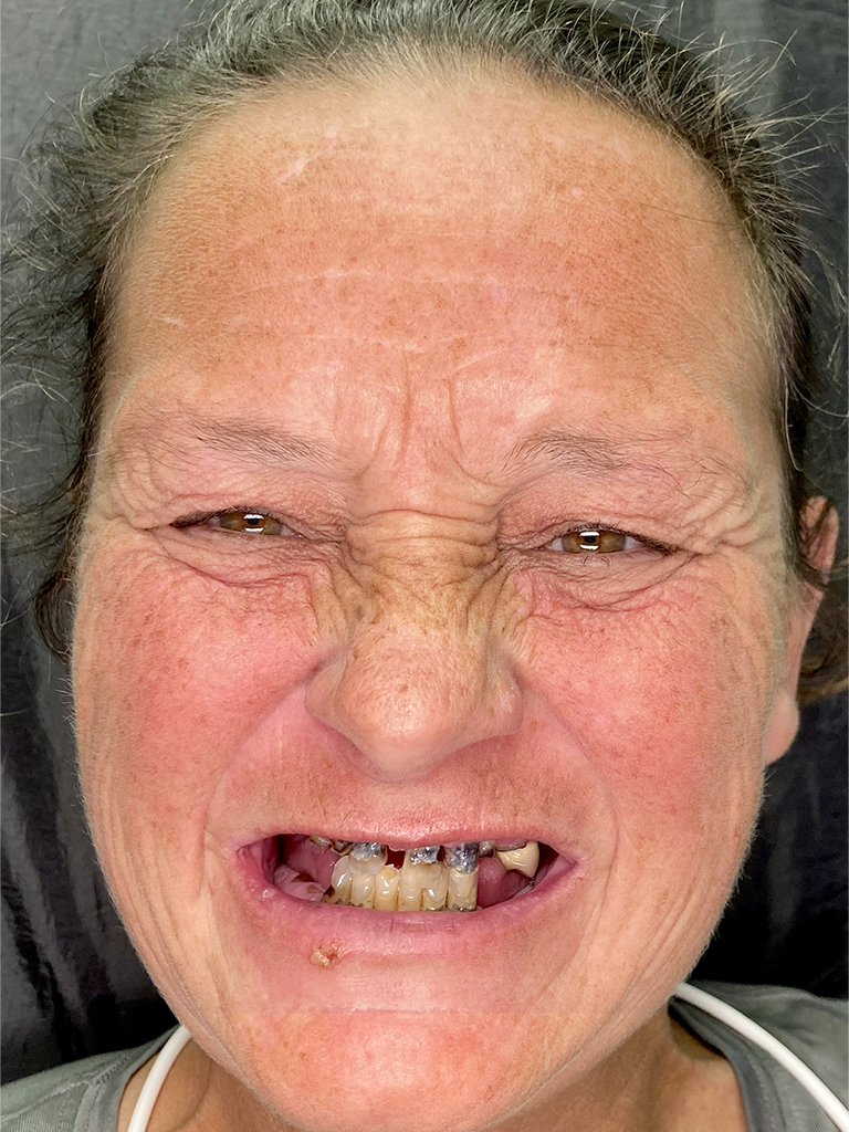 Jaymie-before